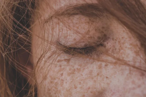 Przyczyny bardzo suchej skóry po 50. roku życia – jak ją wyleczyć